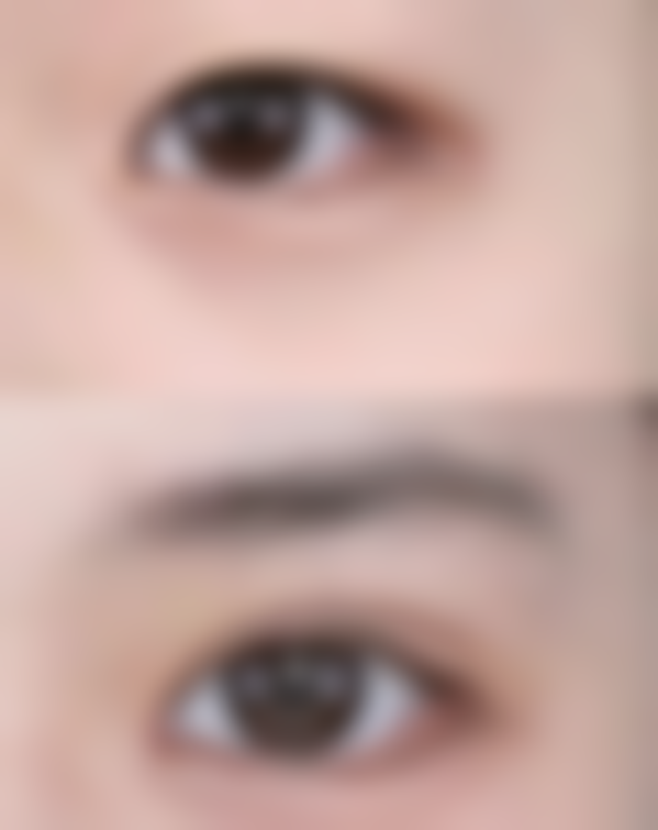 鼻部感觉异常、僵硬能修复吗？