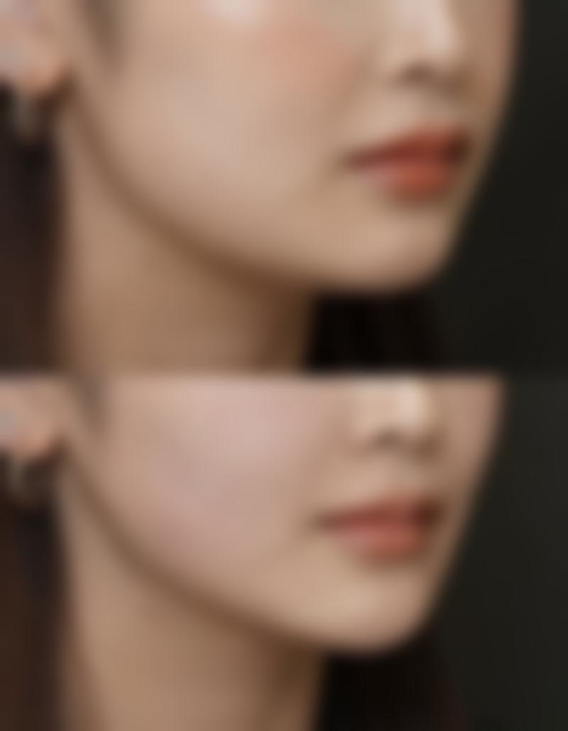 假体移位、歪斜、浮动是怎么回事，如何避免？