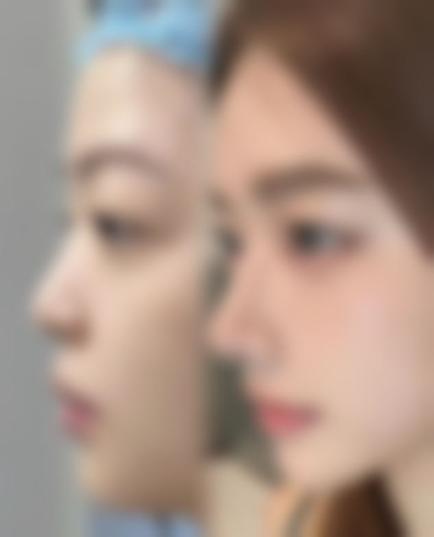 广州从化区城南医院整形美容科正规吗？