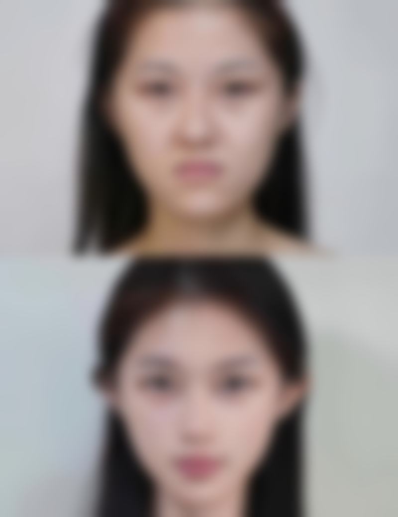 鼻部皮肤会出现哪些问题，如何预防？