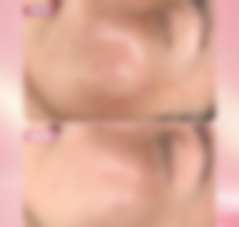 湛江中 心人民医院烧伤整形外科陈审医生烧伤整形技术怎么样？