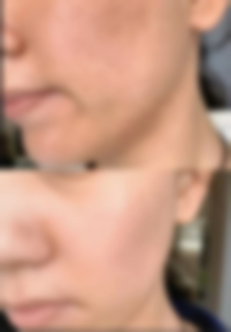 普宁一妍整形医院正规吗？