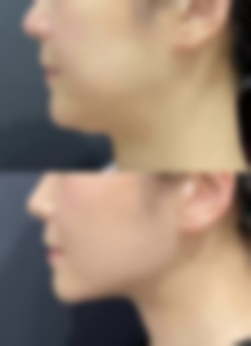 睡眠姿势有什么建议？