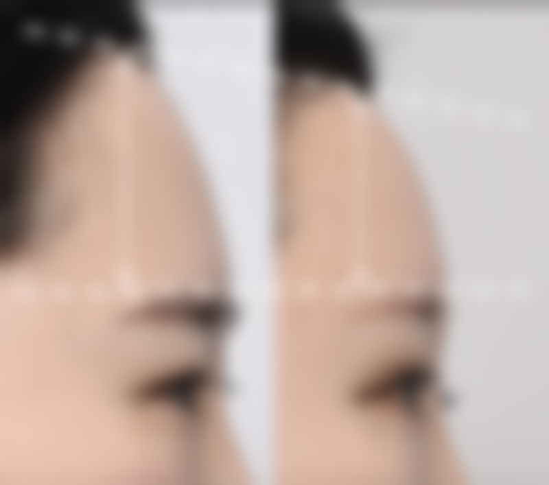 广州艾尚美医疗美容门诊部收费价格表