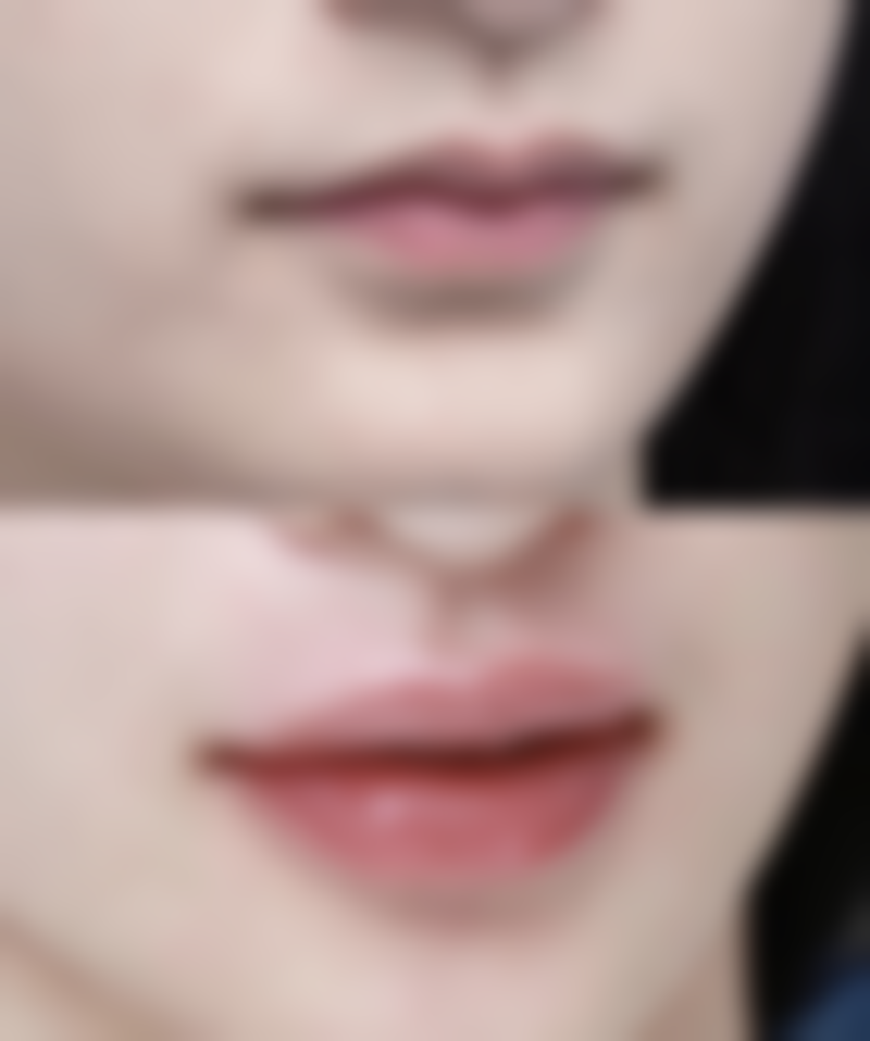 鄂尔多斯朵荔整形正规吗？