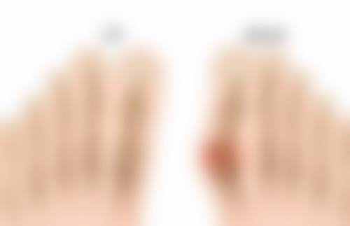 日常护理对手术留下的白色疤痕变回肉色有什么作用？