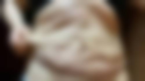 武汉协和医院整形美容中 心冯爱平医生社会职称