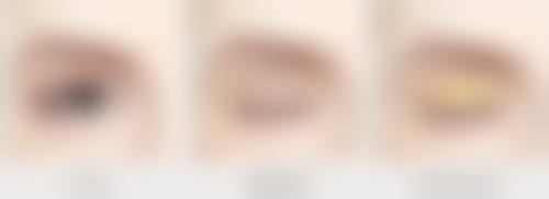 北京奈澈医疗美容医院宗志彬医生鼻部整形技术怎么样?