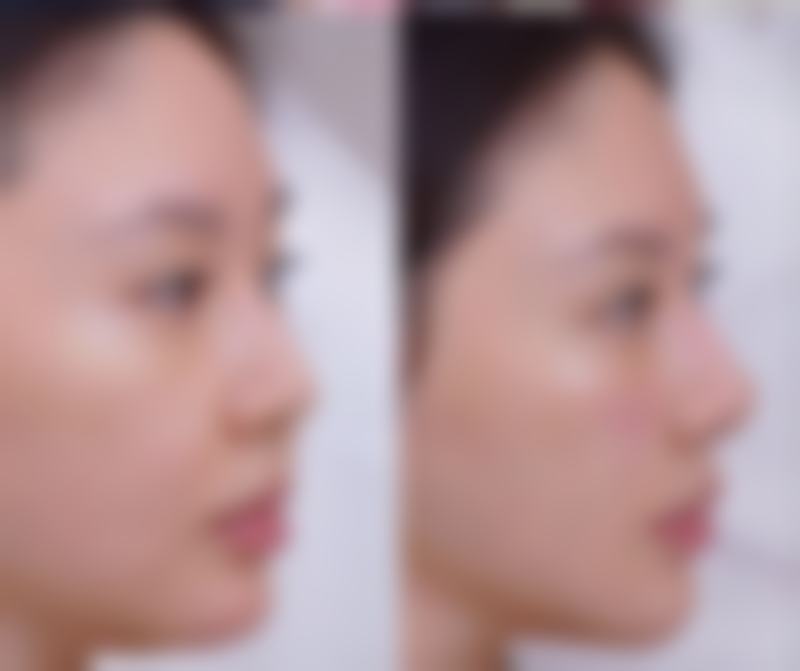 江门市蓬江区俏姿美容口碑评价怎么样?