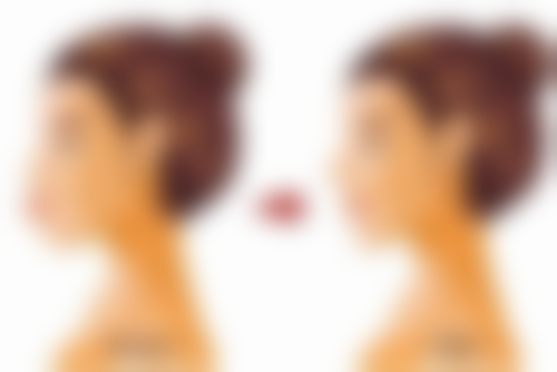 药物治疗烫伤疤痕有哪些方法和注意事项呢？