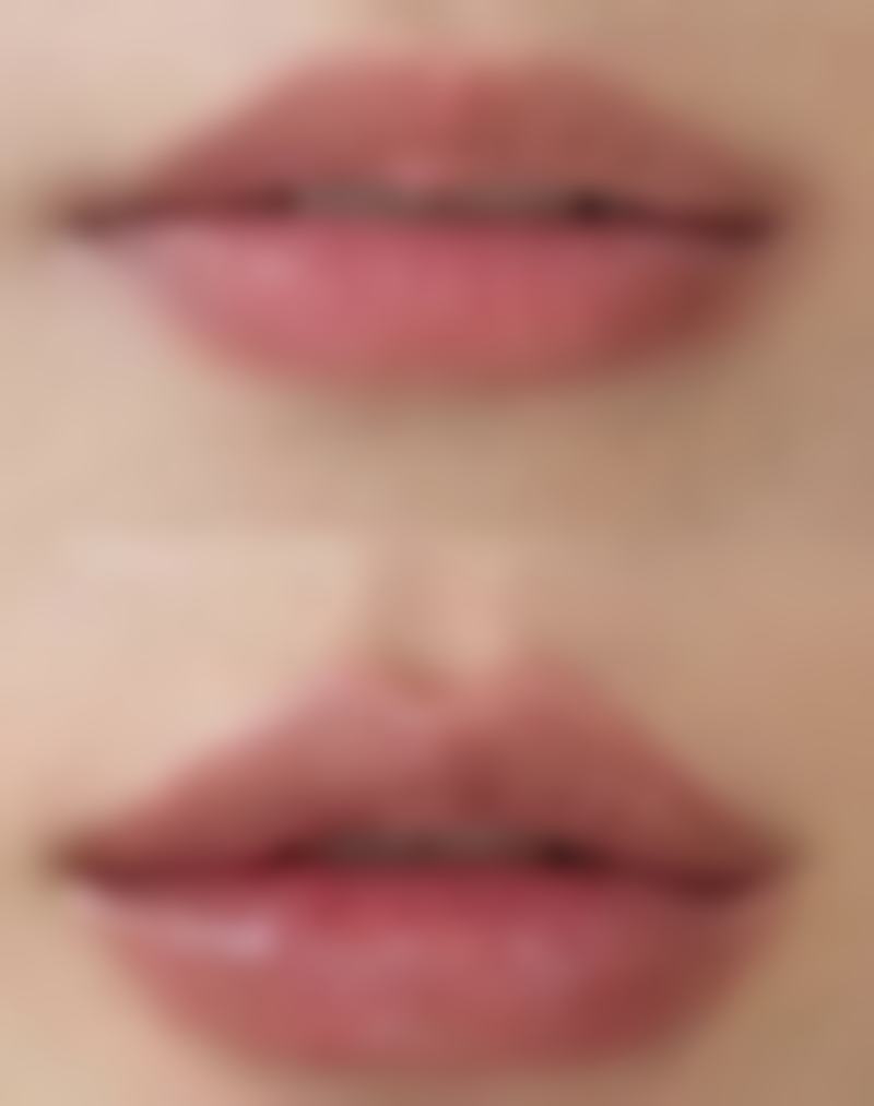 儿童烫伤疤痕治疗有什么特殊注意的吗？