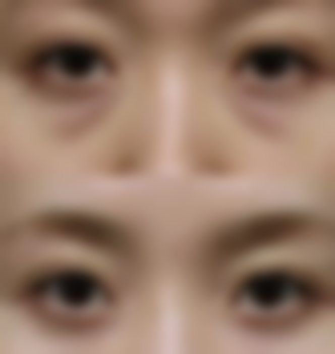 泉州万喜医疗美容门诊部陈石海医生擅长项目