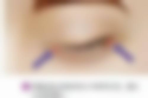 承德伊梦医疗美容诊所口碑评价怎么样？