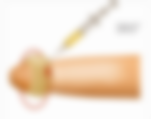 西安允朵医疗美容口碑评价怎么样？