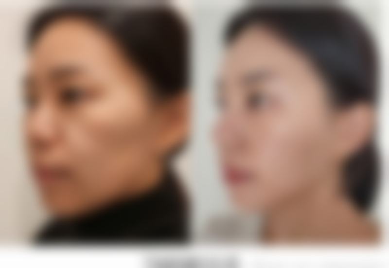 无锡第三人民医院烧伤整形科朱宇刚医生患者评价