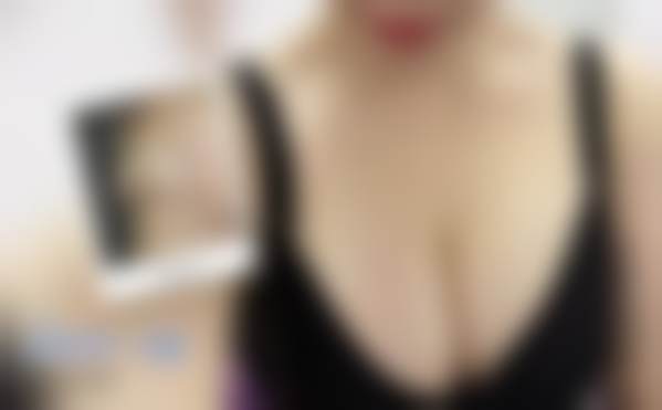 北京禾美嘉医疗美容门诊部贺天遥做过的真实反馈，见证众多顾客变美奇迹超赞！ 