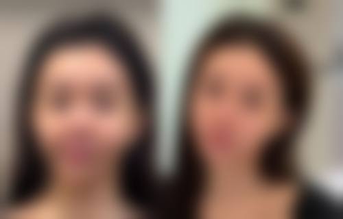 永城华美医疗美容门诊部怎么预约