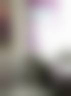 长春朝阳麦西美嘉医疗美容诊所周广宁医生隆鼻技术怎么样？