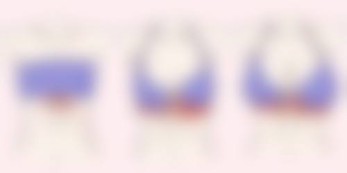 刚割完双眼皮就能吃凤梨吗？