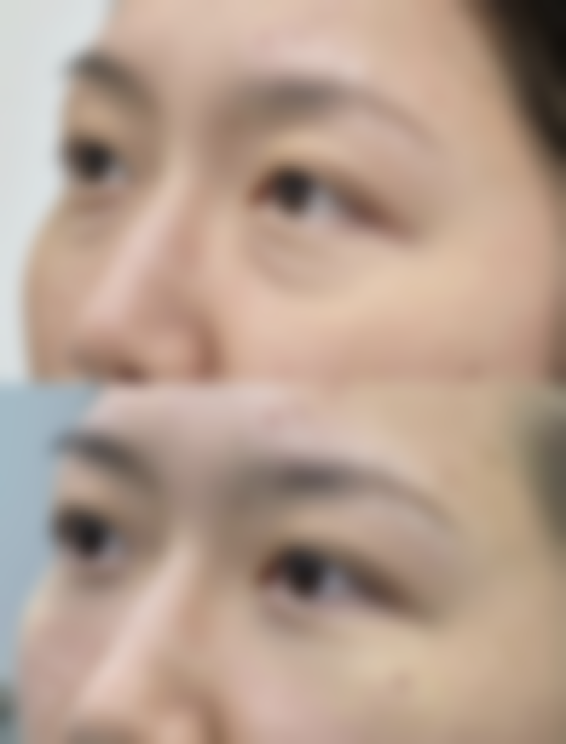 存在哪些极端修复情况？