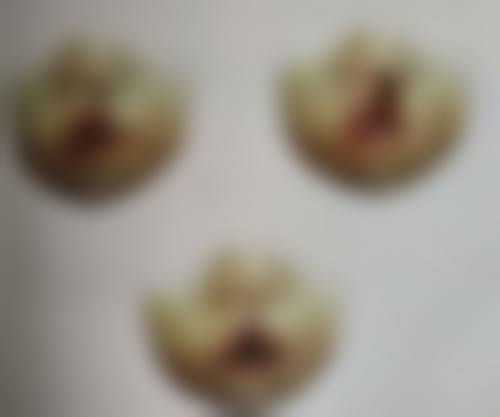 深圳壹希光合医疗美容诊所正规吗？