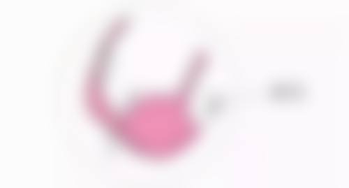 有创手术类丰太阳穴会有血肿或淤血吗？