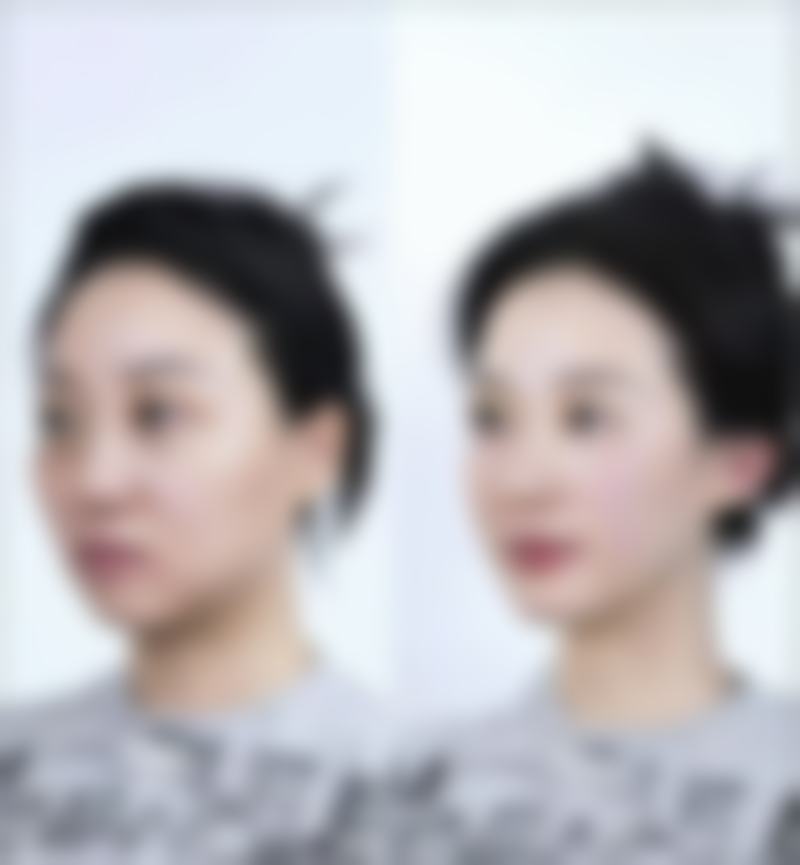 深圳壹希光合医疗美容诊所怎么预约