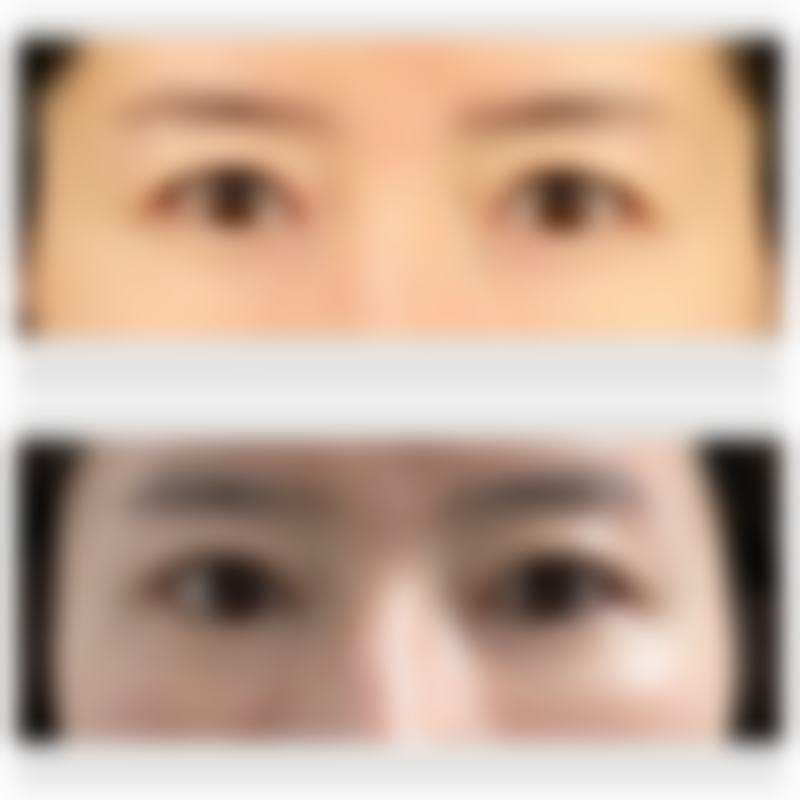 北京明会红整形医院正规吗？