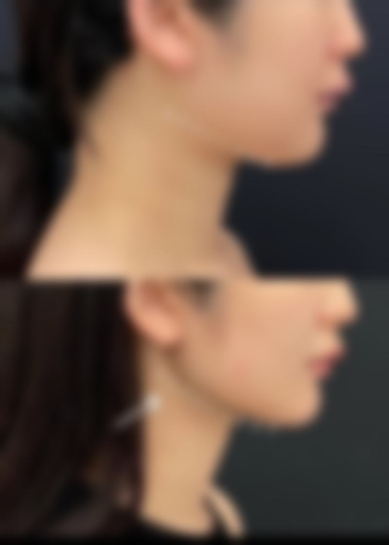 冷热交替护理是怎样的呢？