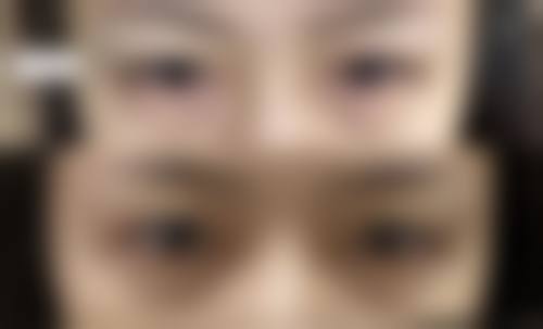 贵州省美容整形外科医院魏在荣医生收费价格