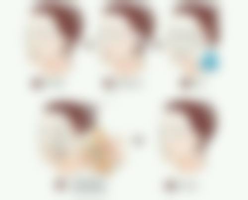 激光去眼袋有什么特点？