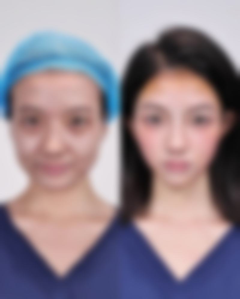抚顺博爱整形医疗美容医院黄昭敏医生面部整形技术怎么样？