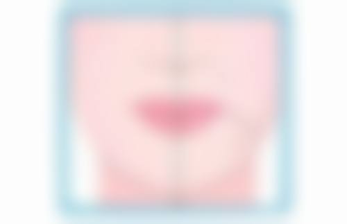 做双眼皮手术前有哪些准备工作呢？这和需不需要人照顾有关系吗？