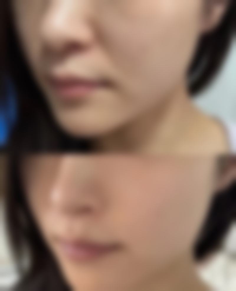 武汉方明美容整形门诊口碑评价怎么样？