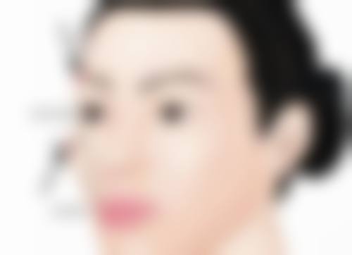 哪些人不适合打瘦脸针呢？