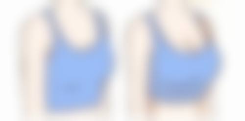 疤痕体质人群的伤口愈合有什么特点？