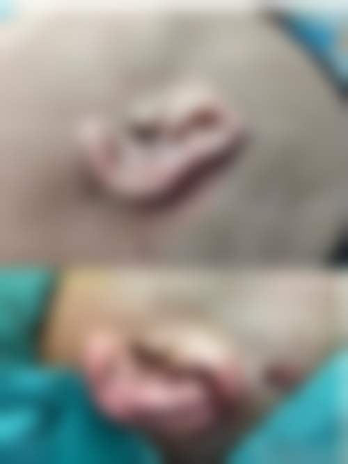 盐城东方女子医院整形科口碑评价怎么样？