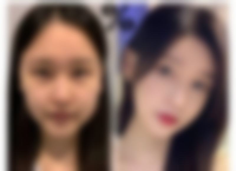 深圳深源医学美容诊所口碑评价怎么样？