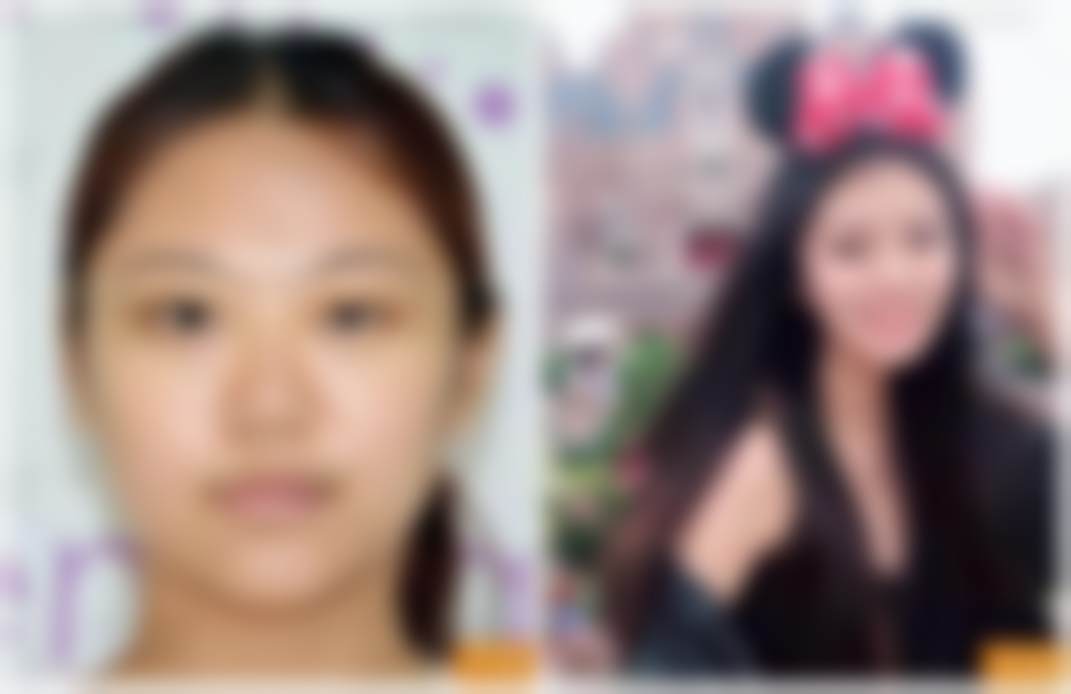 北京禾美嘉医疗美容门诊部刘娟娟医生收费价格