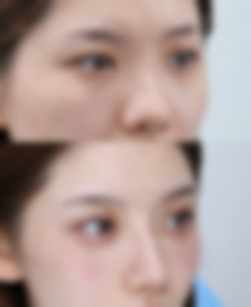 成都赫拉秘语医疗美容诊所口碑评价怎么样？