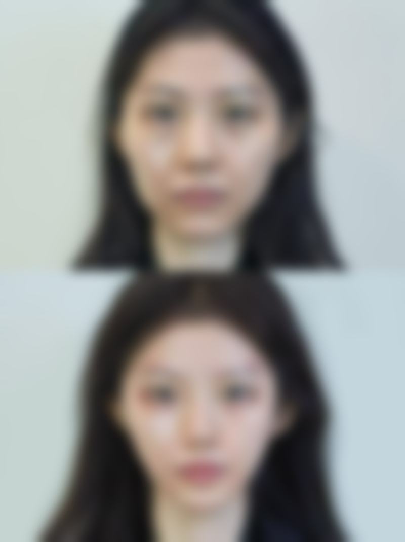 总结