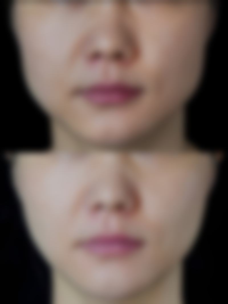 深圳市南山人民医院医疗美容科基本信息