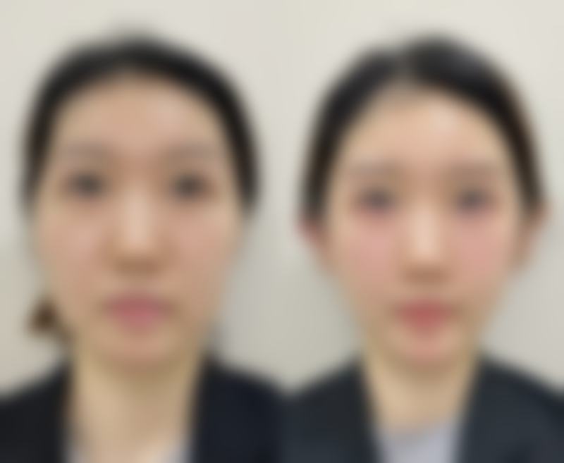 金华美沃整形医院正规吗？