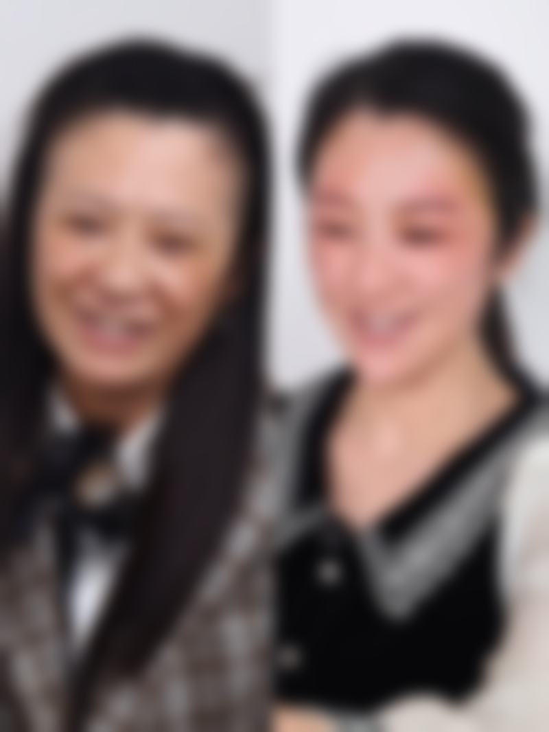白毒瘦脸针适合哪些人群？