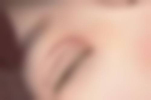 无锡虹桥医院私密刘亚男医生处女膜修补术技术怎么样?