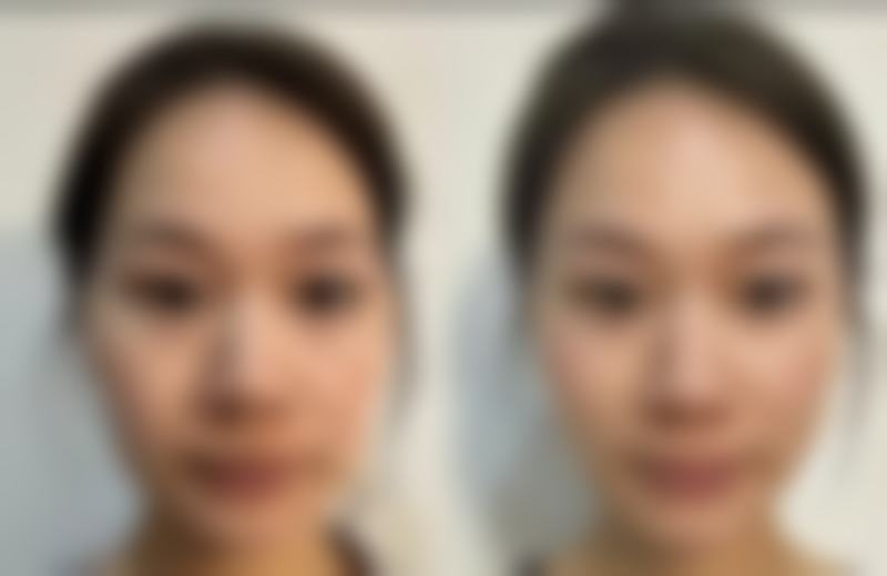 泉州万喜医疗美容门诊部陈石海医生擅长项目