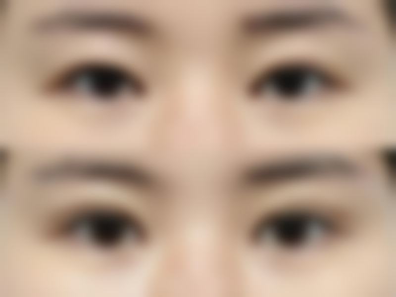 无锡虹桥医院私密刘亚男医生收费价格