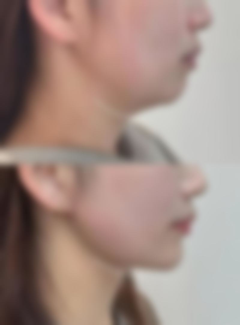 怀化铭逸整形医院怎么预约
