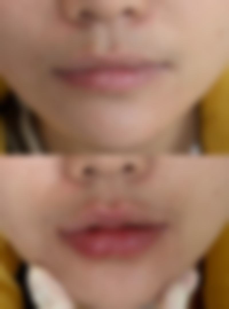 烟台毓璜顶医院整形科正规吗？