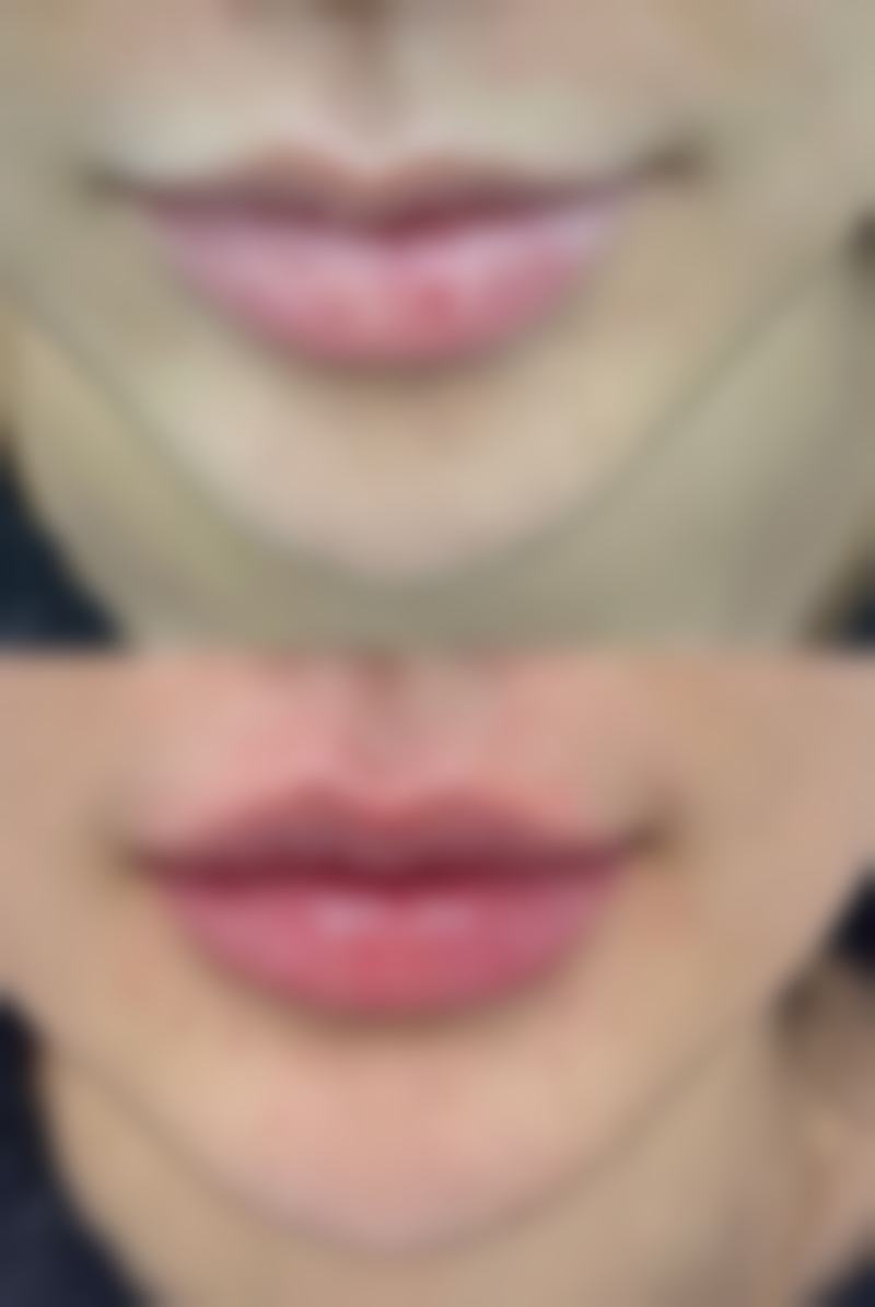 吉安市韩美美容医疗门诊部私密粉嫩项目适合哪些人群?